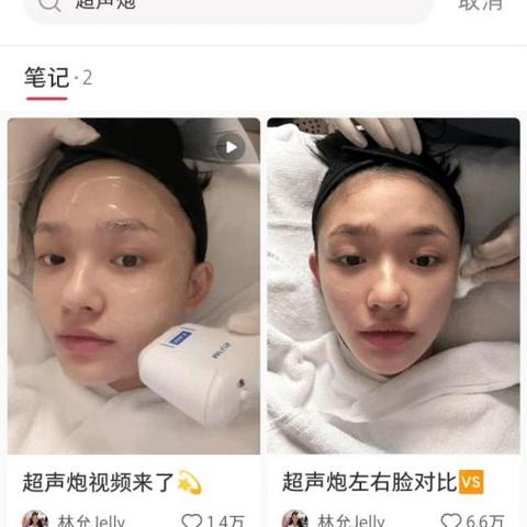 官方阐述：2025正版资料免费大全详述——周期波动 ／ 抗衰性强